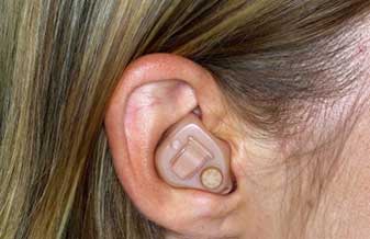 Audio Clin Aparelhos Auditivos - Foto 1