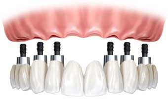 Laboratorio De Protese Dentaria Melro - Foto 1